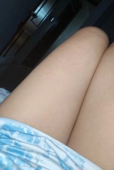 20250417_073207.jpg